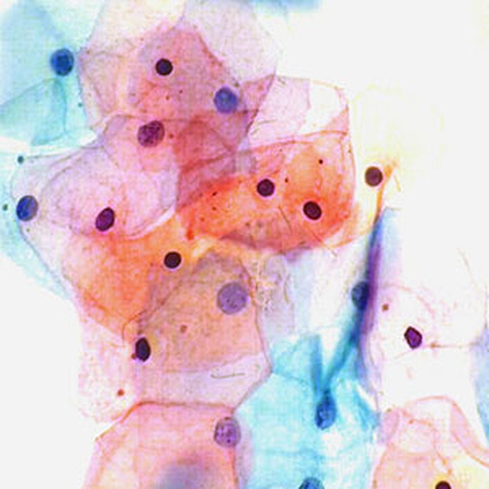 Papanicolaou orange polychromatique