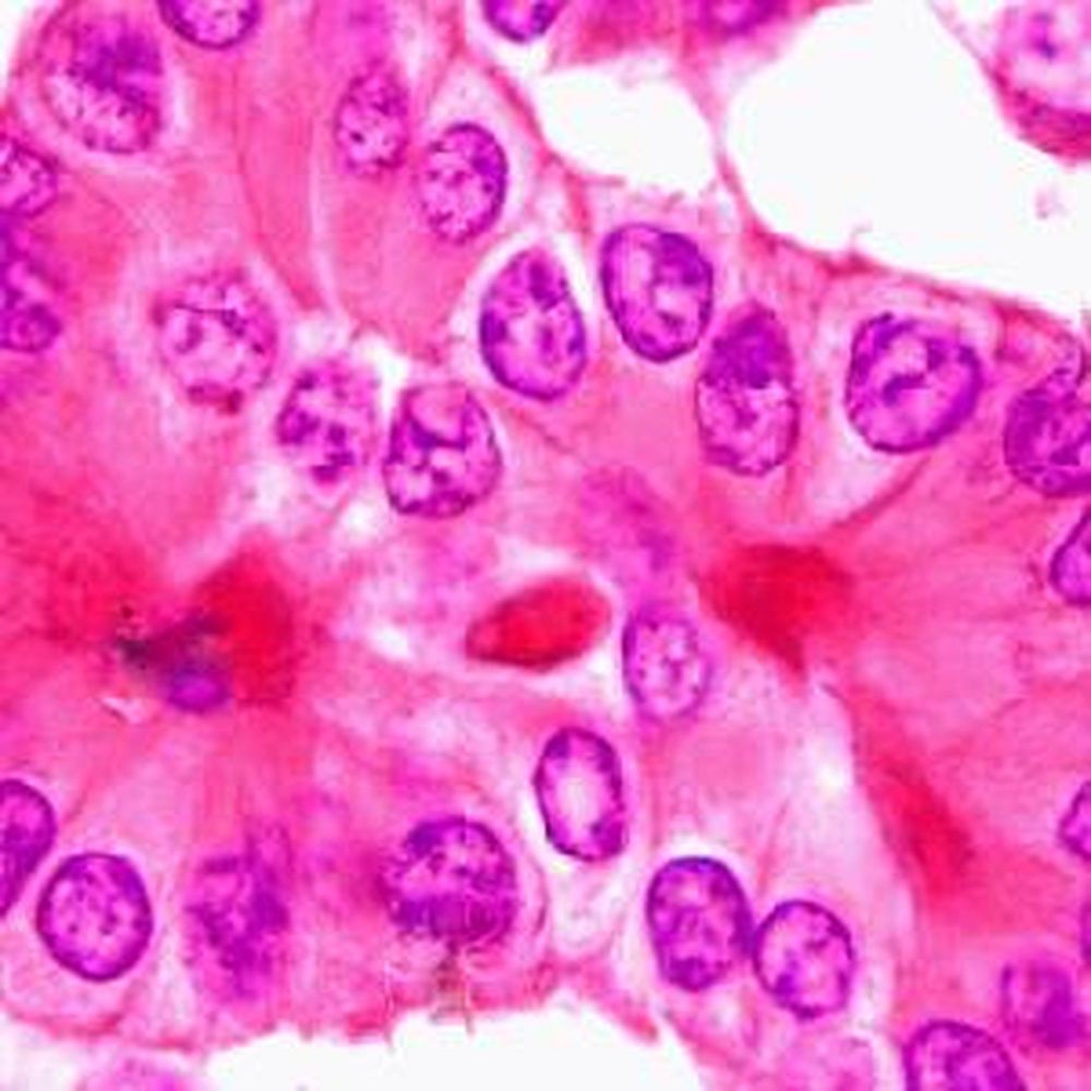 Hématoxyline de Harris solution modifiée selon AB pour coupes histologiques fixes en Bouin