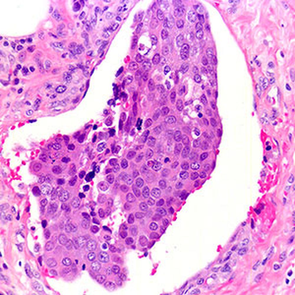 Erythrosine B
