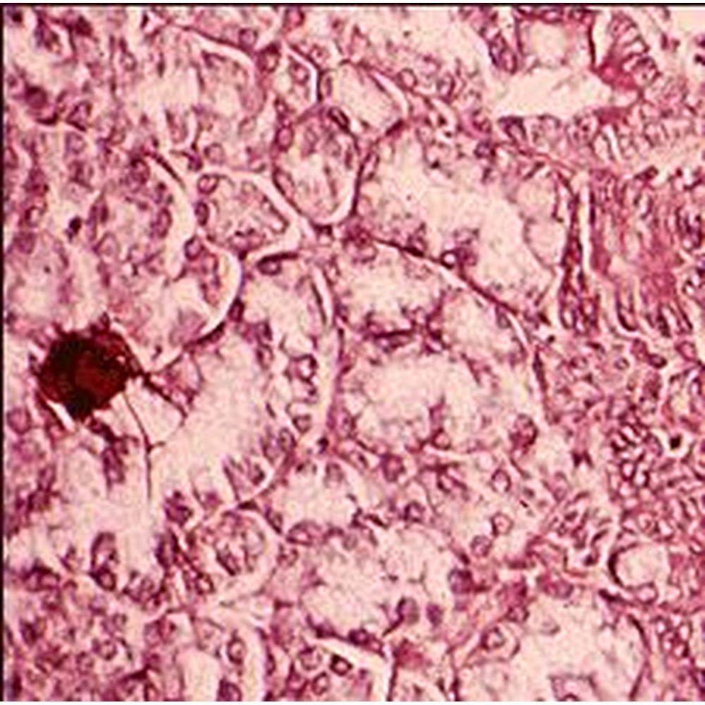 Phloxine B de Gram