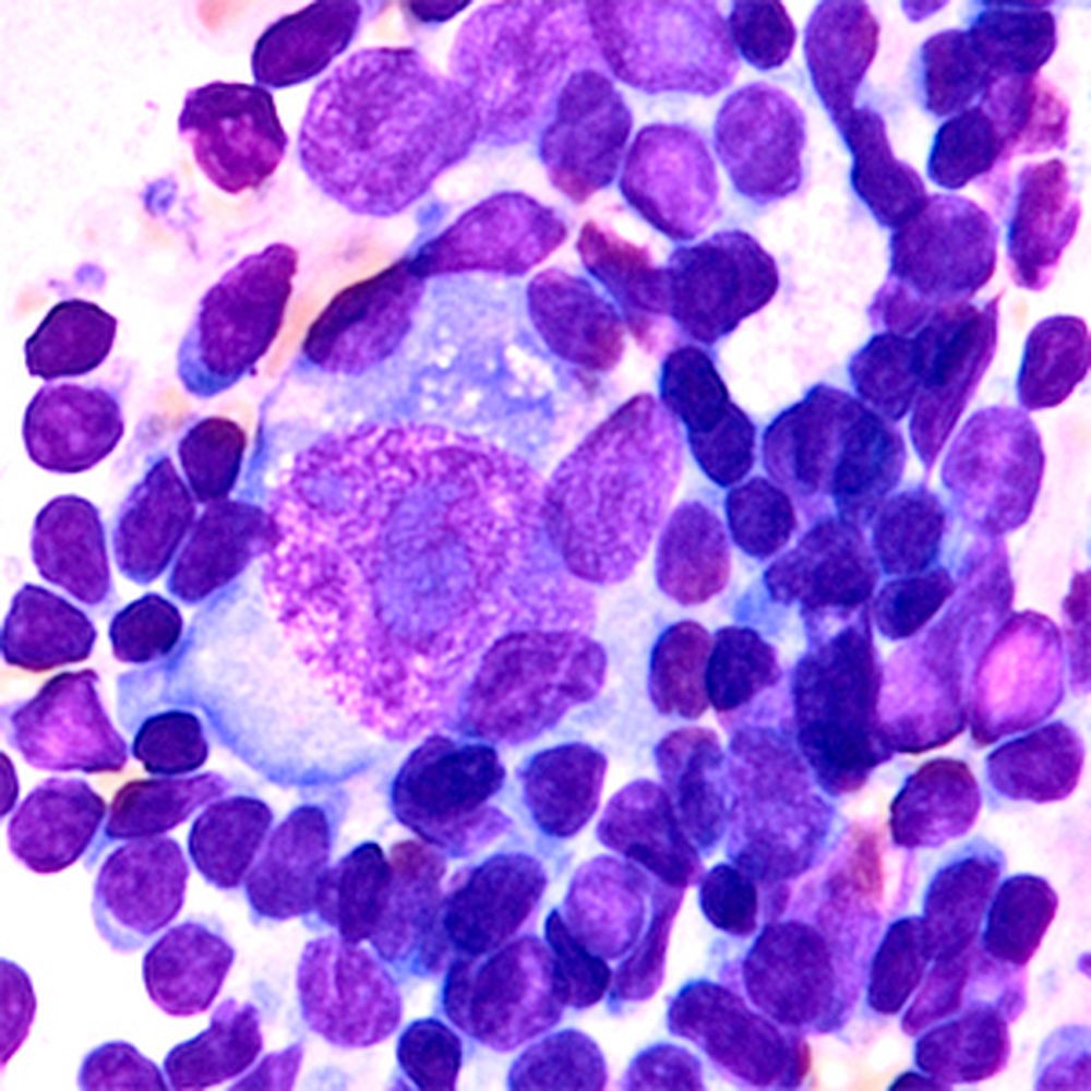 Giemsa lente en solution concentrée pour la microscopie