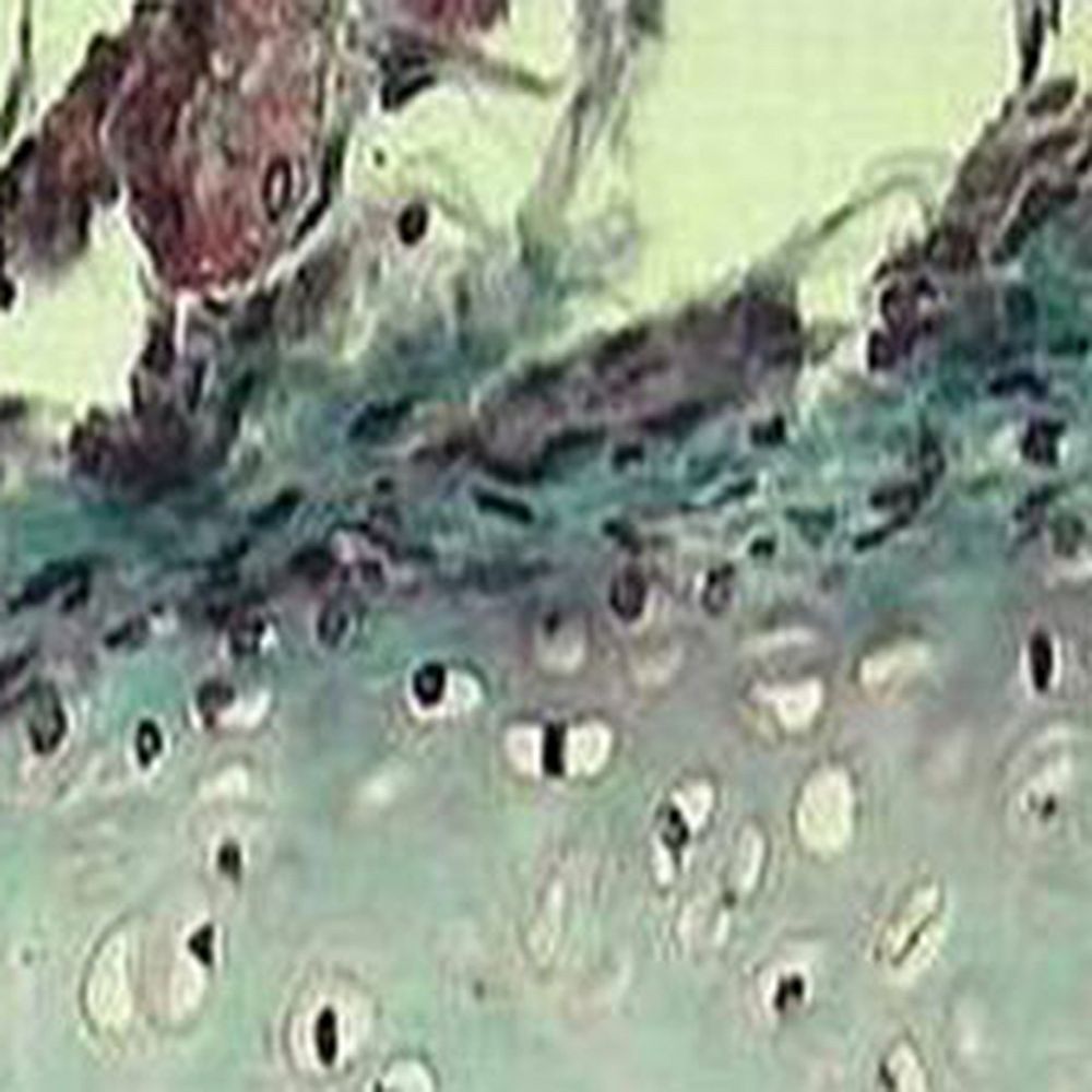 Kit Trichrome de Masson variante au vert lumière