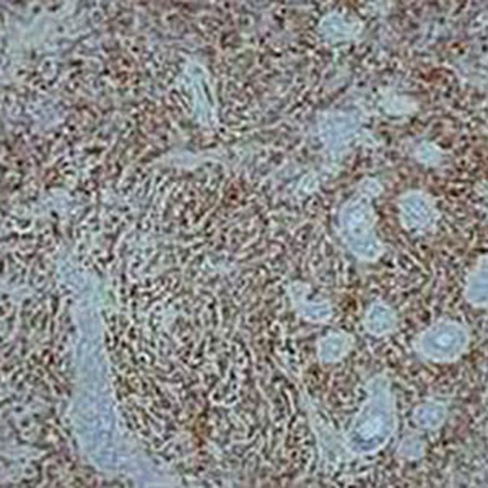 Kit Myéloperoxydase selon Kaplow (méthode benzidine)