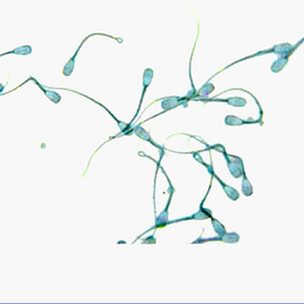 Eosine pour la vitalité des spermatozoïdes
