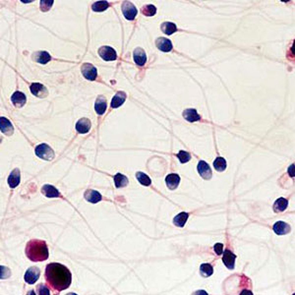 Spermoscan, coloration rapide pour spermocytogramme
