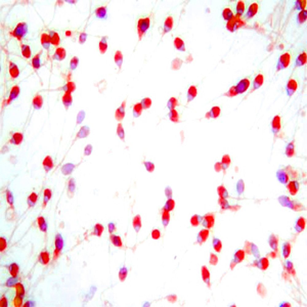 Diluant pour spermatozoïdes