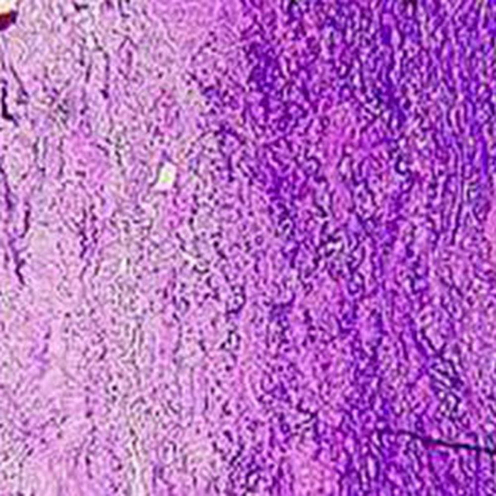Kit Fuchsine paraldéhyde selon Gomori