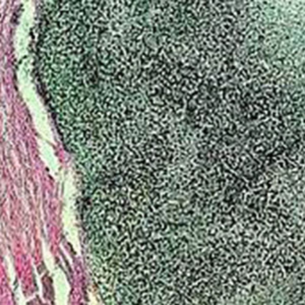 Kit Argent selon Von Kossa pour la détection de la micro calcification