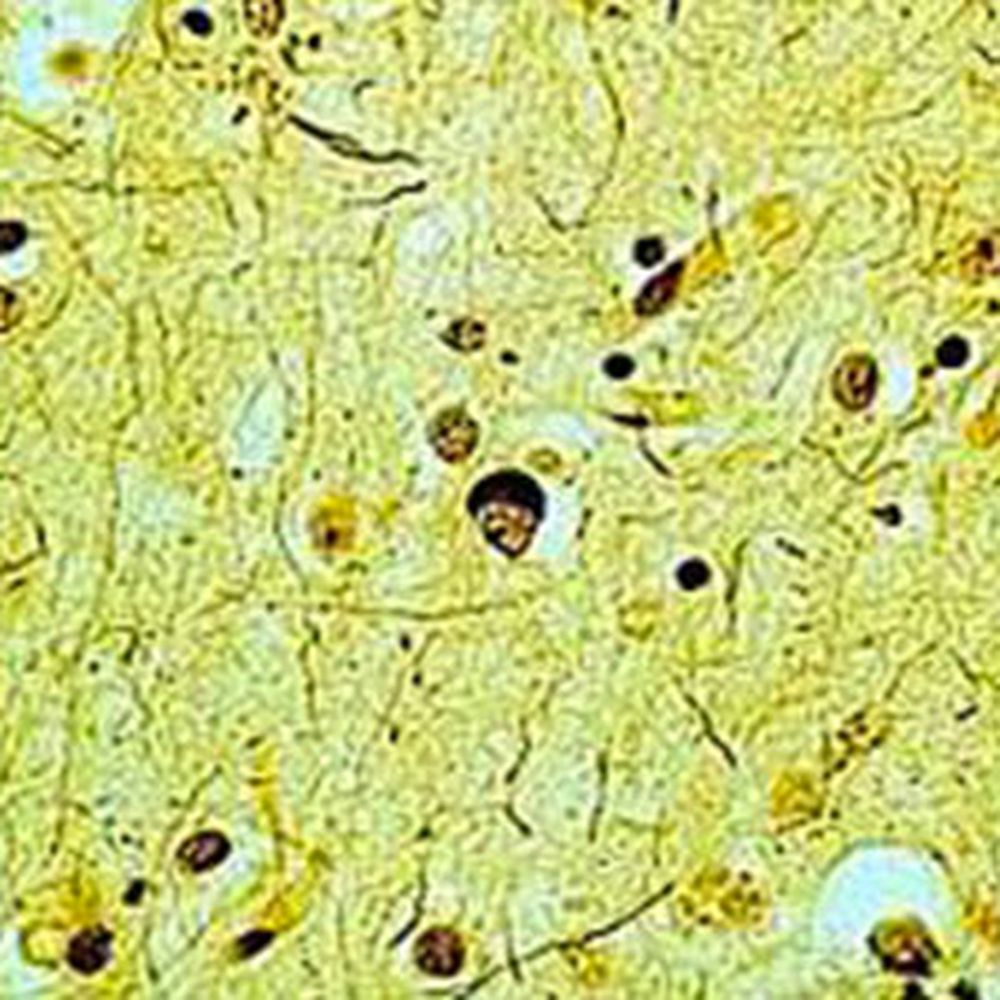 Kit Coloration selon Bielschowsky pour plaques séniles
